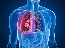 Всероссийская научно-практическая конференция «Рак лёгкого – новые подходы в лечении и сопроводительной терапии»