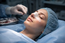 Ринопластика