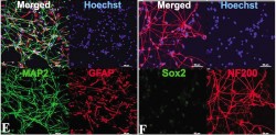Рис. 1. Нейроны, полученные из прямо репрограммированных нейральных стволовых клеток. Фрагмент рисунка из публикации Baklaushev VP et al, (Sci Rep, 2019)